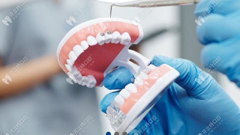牙周治疗，如何选择上海优质医院？**