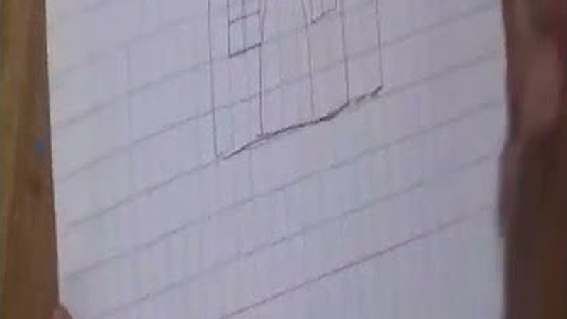 儿童拔牙价格为什么从几十到上千元不等
