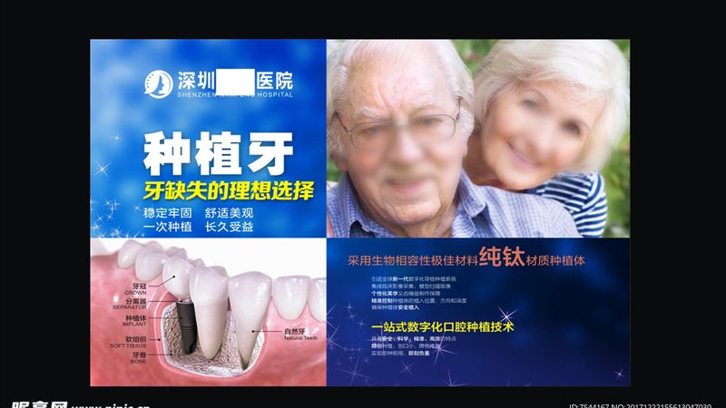 全口种植牙手术：揭秘手术步骤与流程